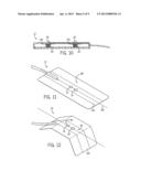 SENSOR SYSTEM WITH PRESSURE APPLICATION diagram and image