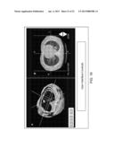 SYSTEMS AND METHODS FOR PLANNING IMAGE GUIDED INTERVENTIONAL PROCEDURES diagram and image