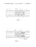 ASSEMBLIES, SYSTEMS, AND METHODS FOR INFUSING THERAPEUTIC AGENTS INTO THE     BODY diagram and image