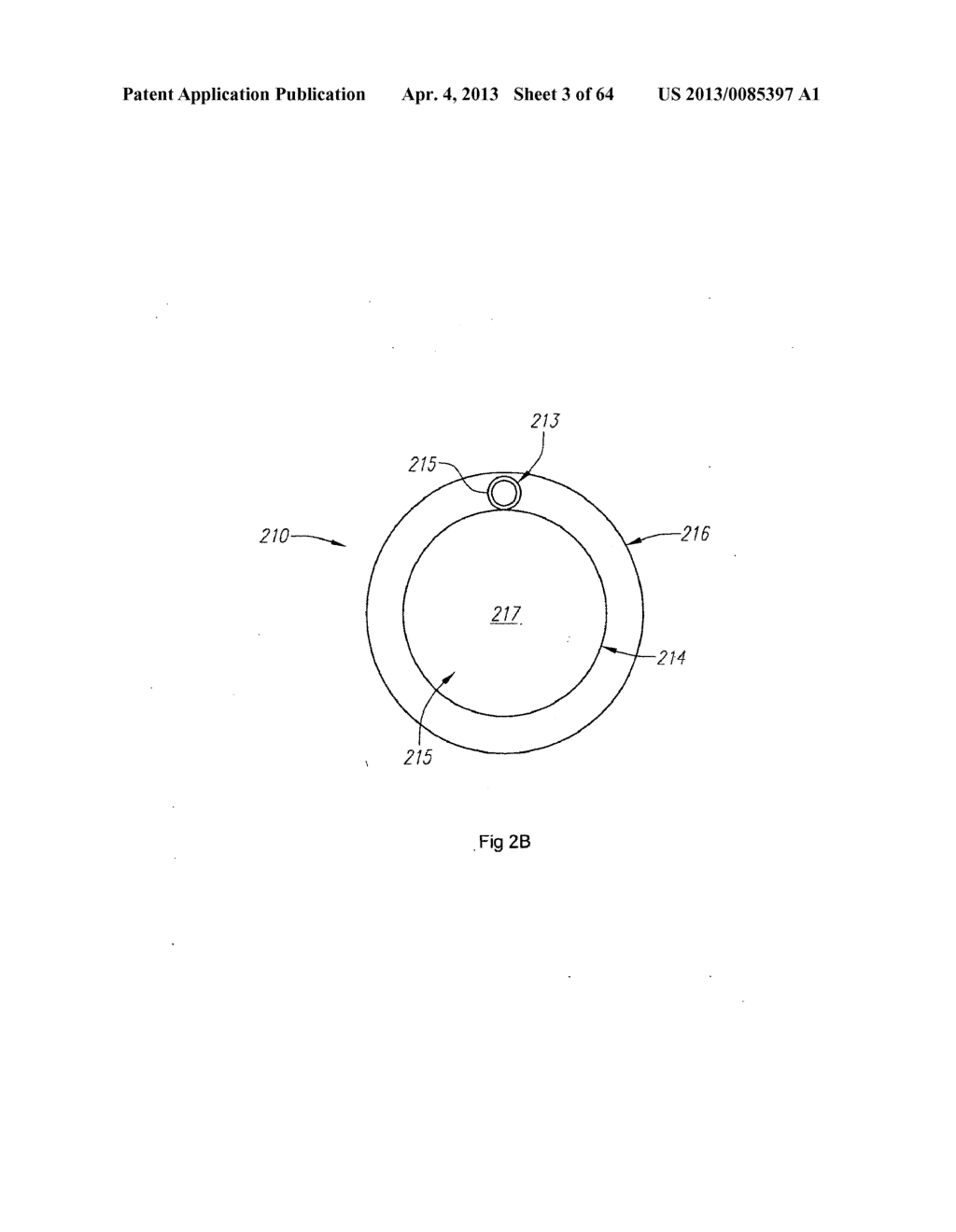 OPTICAL FIBER INSTRUMENT SYSTEM AND METHOD WITH MOTION-BASED ADJUSTMENT - diagram, schematic, and image 04