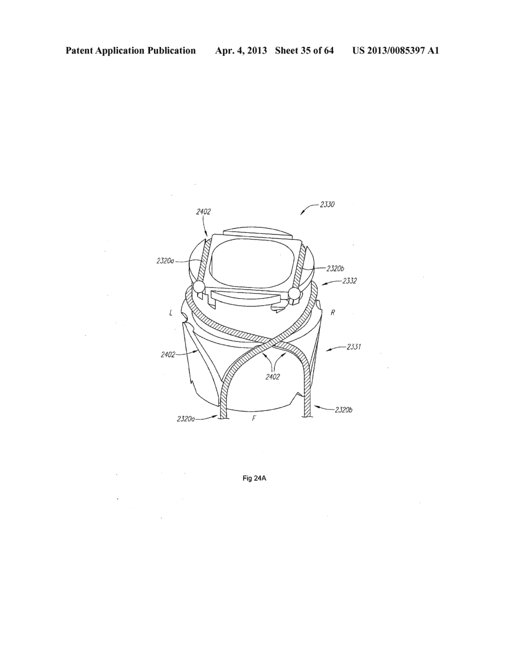 OPTICAL FIBER INSTRUMENT SYSTEM AND METHOD WITH MOTION-BASED ADJUSTMENT - diagram, schematic, and image 36