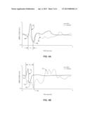 EVALUATION OF CARDIAC DYSSYNCHRONY BASED ON CHEST WALL MOTION AND     ELECTRICAL CARDIAC ACTIVITY diagram and image