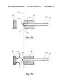 ANATOMICAL-POSITIONING APPARATUS AND METHOD WITH AN EXPANDABLE DEVICE diagram and image