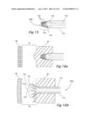 ANATOMICAL-POSITIONING APPARATUS AND METHOD WITH AN EXPANDABLE DEVICE diagram and image