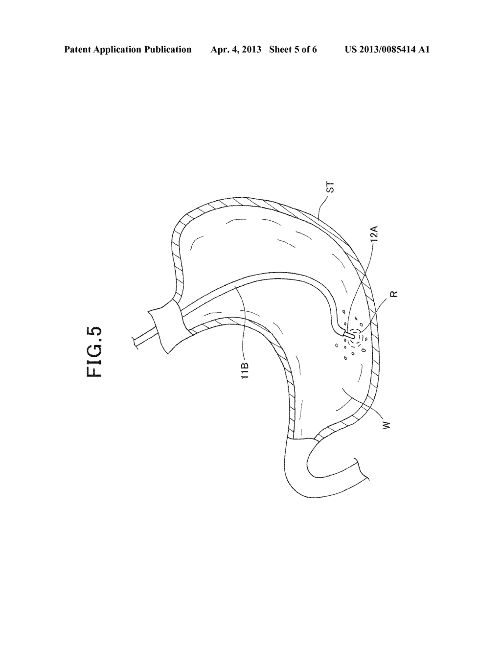 METHOD OF TAKING OUT LIQUID PRESENT INSIDE SUBJECT THEREFROM - diagram, schematic, and image 06