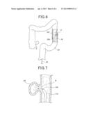 METHOD OF TAKING OUT LIQUID PRESENT INSIDE SUBJECT THEREFROM diagram and image