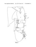 BRACE FOR CORRECTION OF HUMERAL FRACTURES diagram and image