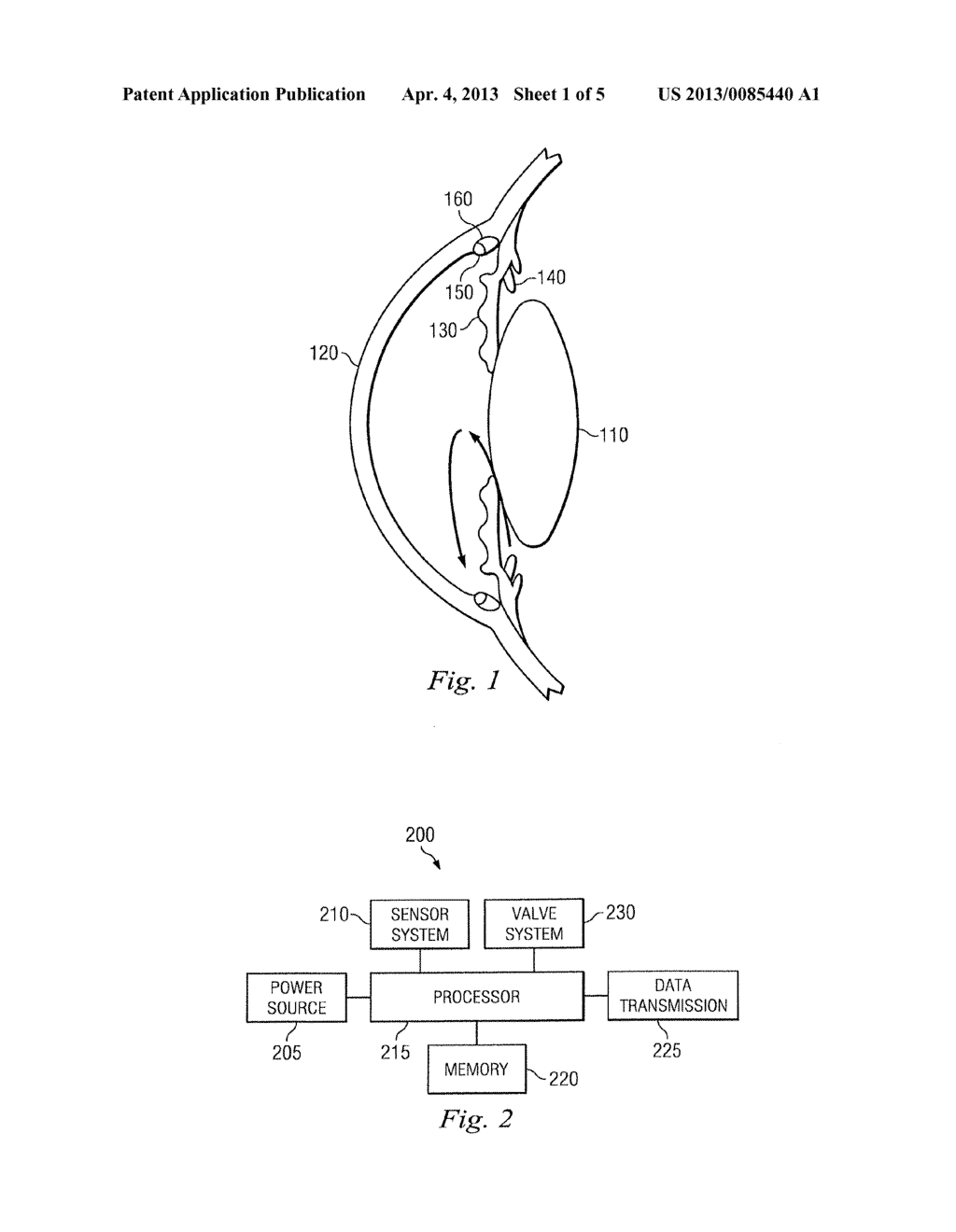 Selectable Varied Control Valve Systems For IOP Control Systems - diagram, schematic, and image 02