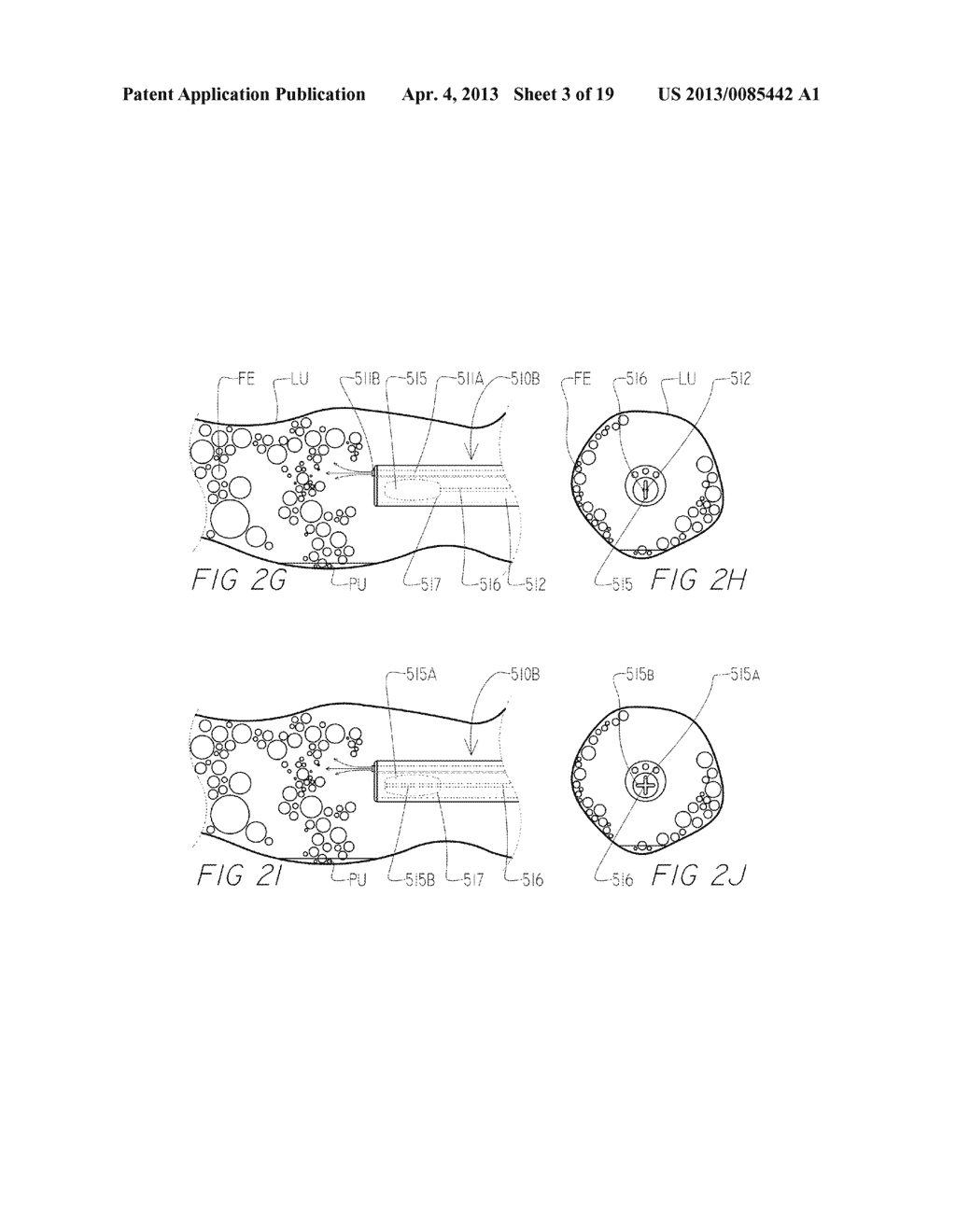 SYSTEMS AND METHODS FOR CLEANING BODY CAVITIES - diagram, schematic, and image 04