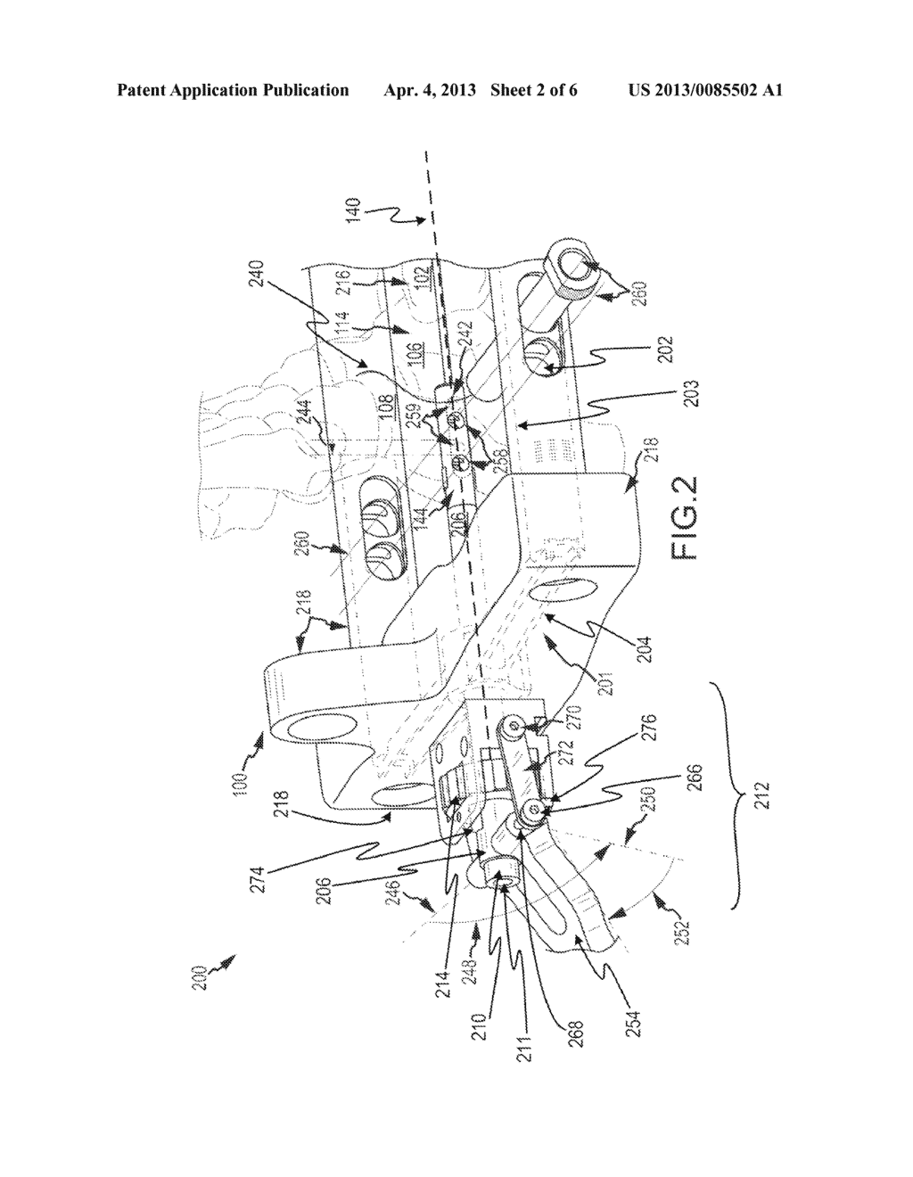 METHOD AND APPARATUS FOR INSTALLATION OF INTRAMEDULLARY MEDICAL DEVICE - diagram, schematic, and image 03