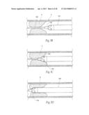 ATHERECTOMY DEVICES AND METHODS diagram and image