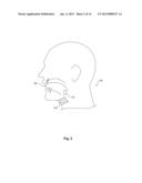 APPARATUS AND METHODS FOR IMPLANT COUPLING INDICATION diagram and image