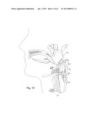 APPARATUS AND METHODS FOR IMPLANT COUPLING INDICATION diagram and image