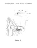 Devices and Methods for Delivering Energy as a Function of Condition     Severity diagram and image