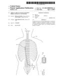 MEDICAL IMPLANT RANGE EXTENSION BRIDGE APPARATUS AND METHOD diagram and image