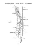 MEDICAL IMPLANT RANGE EXTENSION BRIDGE APPARATUS AND METHOD diagram and image