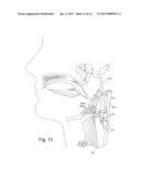 Modulator Apparatus Configured for Implantation diagram and image