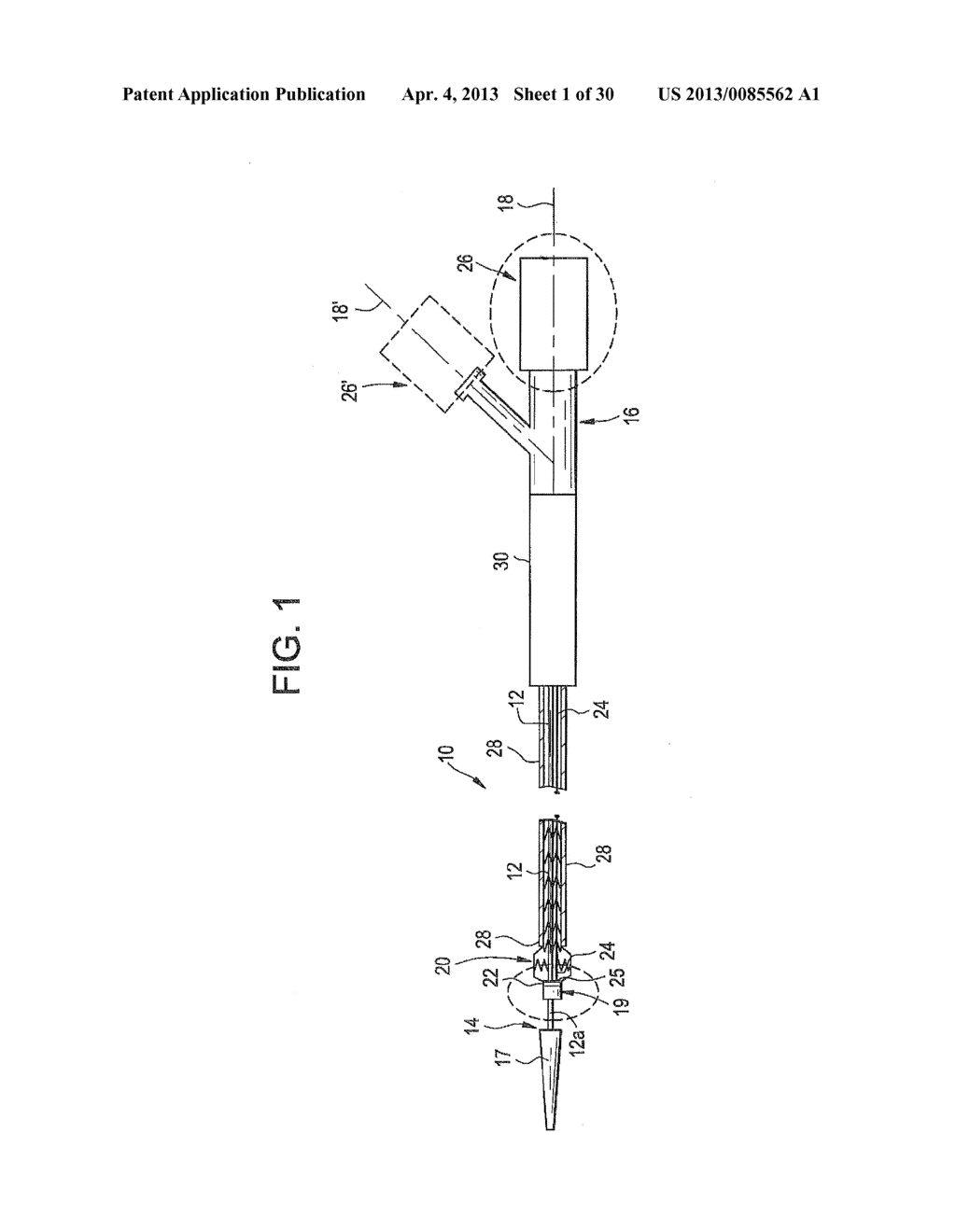 APPARATUS FOR AND METHOD OF PULLING A TENSILE MEMBER FROM A MEDICAL DEVICE - diagram, schematic, and image 02
