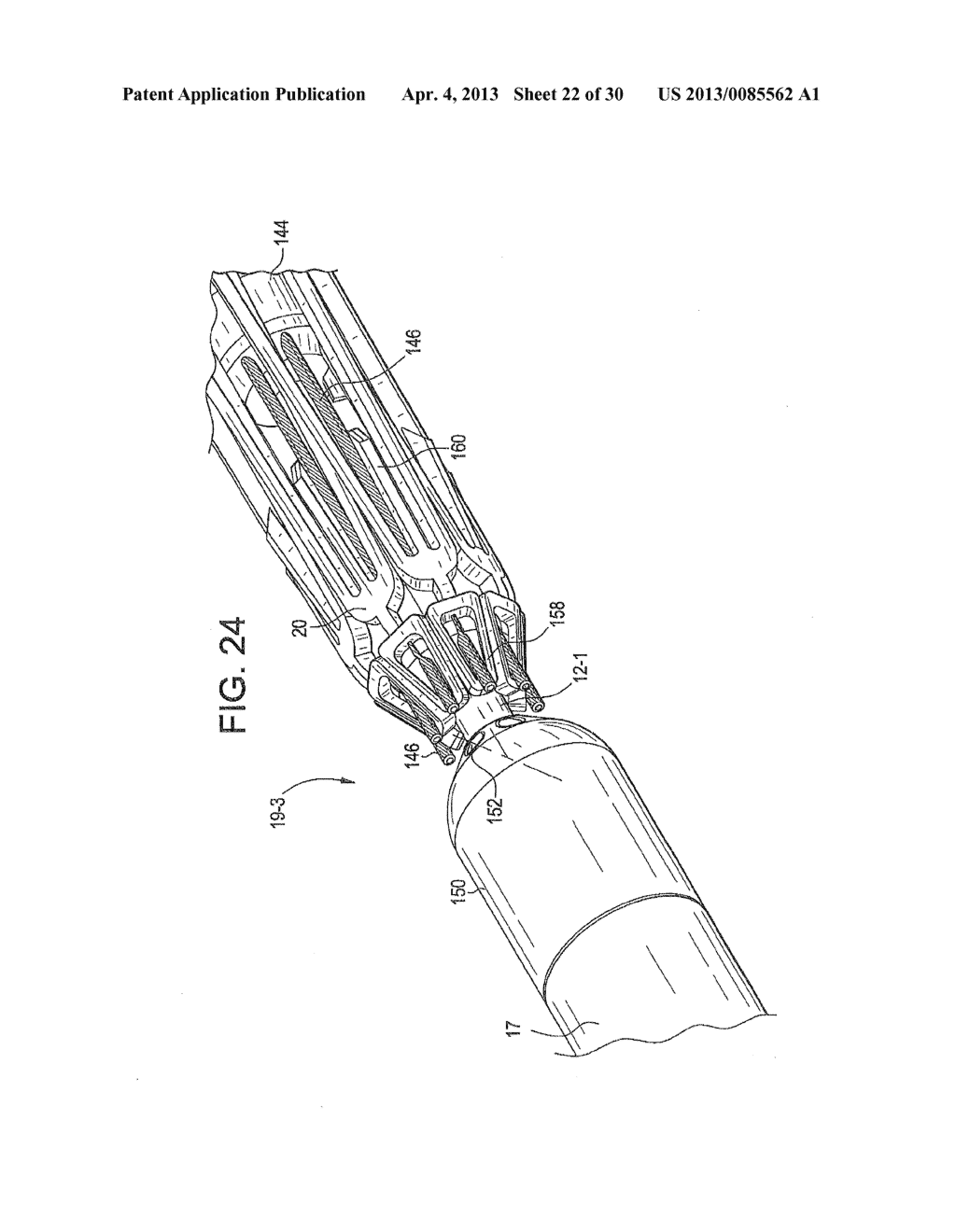 APPARATUS FOR AND METHOD OF PULLING A TENSILE MEMBER FROM A MEDICAL DEVICE - diagram, schematic, and image 23