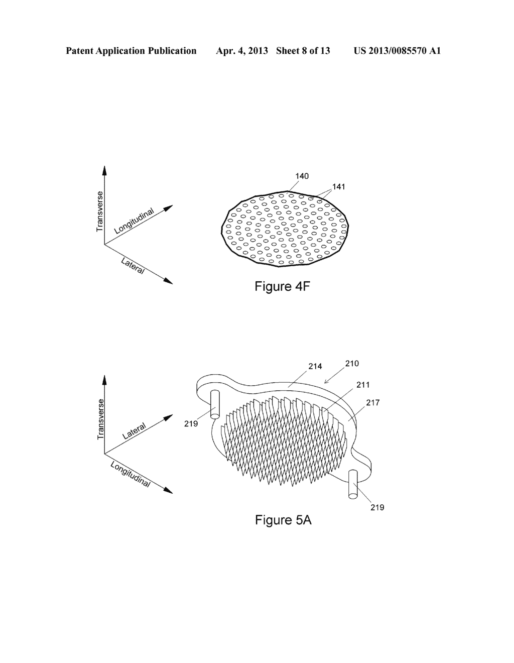 FENESTRATOR DEVICE AND RELATED METHODS - diagram, schematic, and image 09