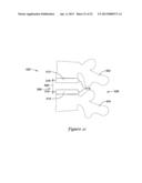 INTERBODY VERTEBRAL SPACER diagram and image