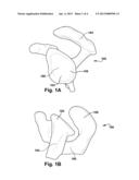 SYNTHETIC BONE MODEL AND METHOD FOR PROVIDING SAME diagram and image