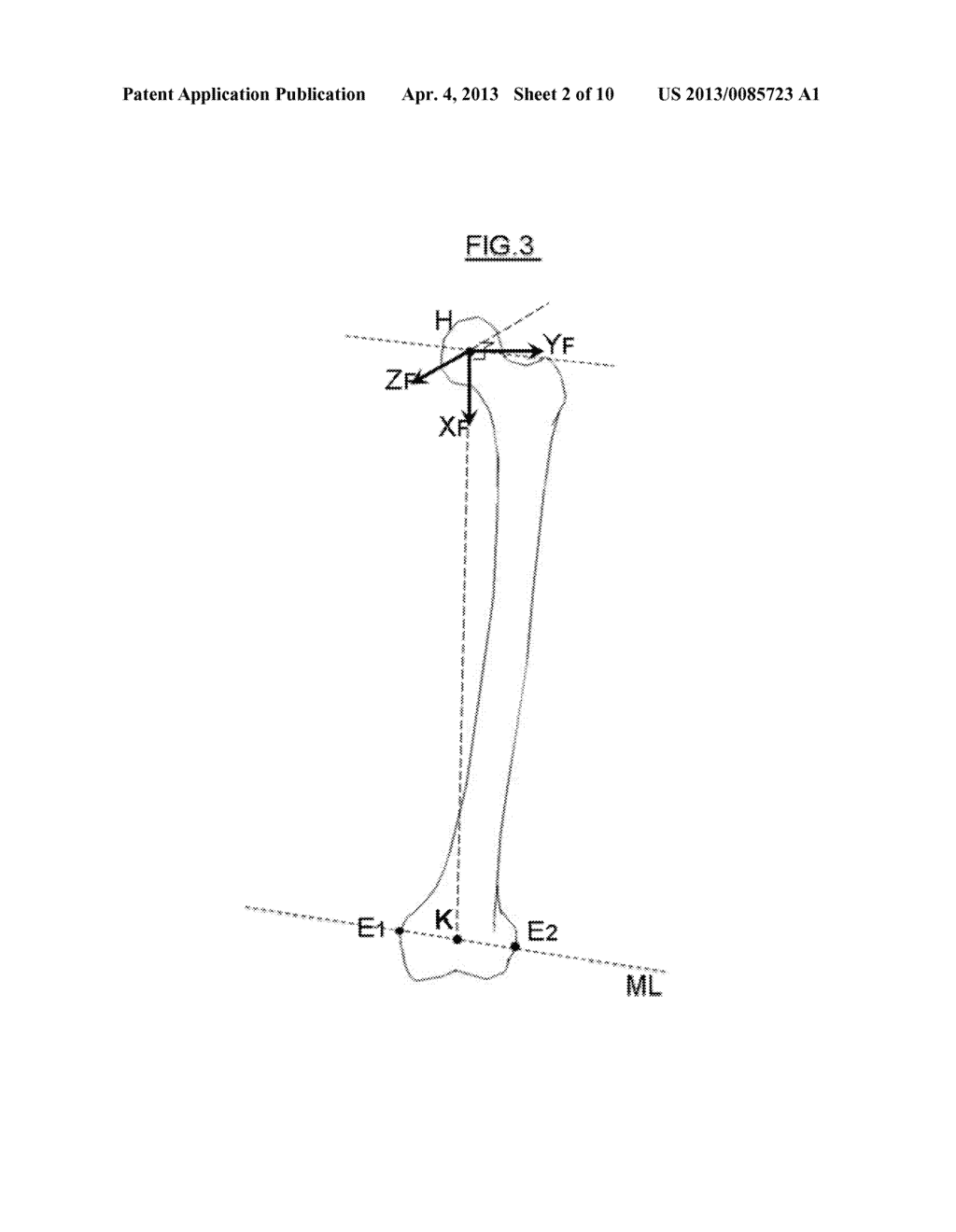 METHOD FOR DETERMINING ARTICULAR BONE DEFORMITY RESECTION USING MOTION     PATTERNS - diagram, schematic, and image 03