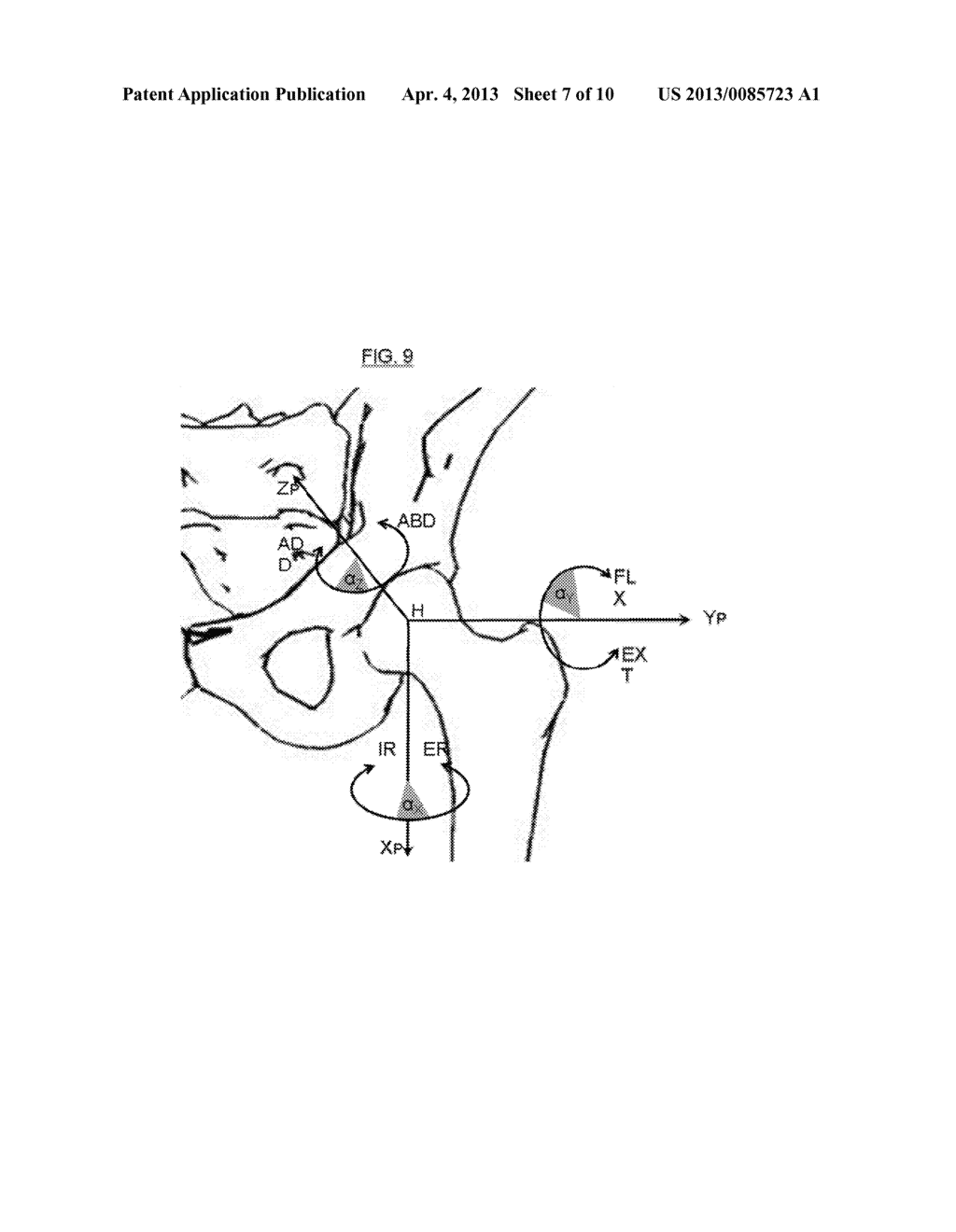 METHOD FOR DETERMINING ARTICULAR BONE DEFORMITY RESECTION USING MOTION     PATTERNS - diagram, schematic, and image 08