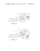 SURGICAL INSTRUMENT PACKAGING CLIP SYSTEM diagram and image