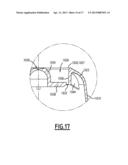 CAPSULE HAVING A RUPTURE INITIATION AREA diagram and image