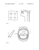 TISSUE CROSSLINKING FOR TREATMENT OF SNORING AND OBSTRUCTIVE SLEEP APNEA diagram and image