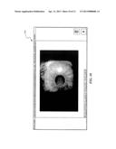 EYE IMAGE AND VIDEO CAPTURE SYSTEM AND ASSOCIATED  METHODS diagram and image