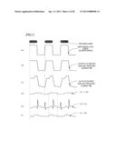 OPTICAL READ/WRITE APPARATUS diagram and image