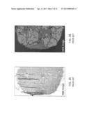 METHOD AND SYSTEM FOR ANALYZING BIOLOGICAL SPECIMENS BY SPECTRAL IMAGING diagram and image