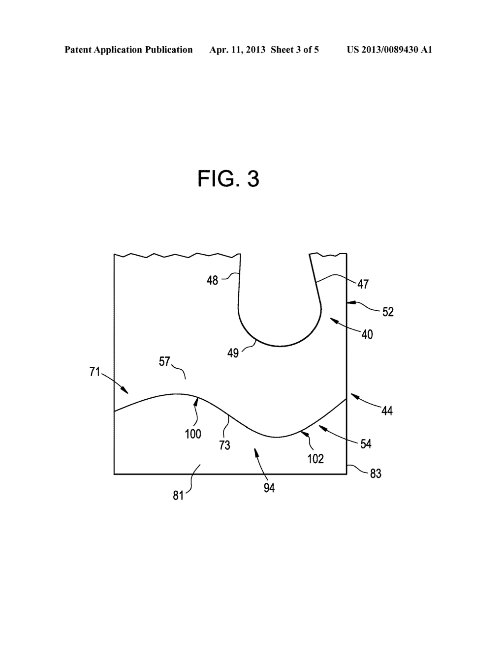 TURBOMACHINE COMPONENT HAVING A FLOW CONTOUR FEATURE - diagram, schematic, and image 04