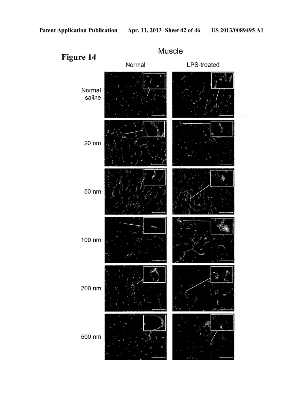 METHOD FOR SCREENING SIZE OF CARRIER - diagram, schematic, and image 43