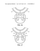 MOUTHPIECE FOR CLEANING TEETH WITH A MECHANICAL DRIVE TRAIN diagram and image