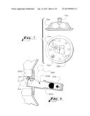 Pressure Activated Ball Game diagram and image