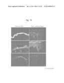 Biological Markers of Chronic Wound Tissue and Methods of Using for     Criteria in Surgical Debridement diagram and image