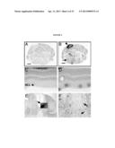 METHODS FOR THE TREATMENT OF TAY-SACHS DISEASE, SANDHOFF DISEASE, AND     GM1-GANGLIOSIDOSIS diagram and image