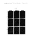 METHODS FOR THE TREATMENT OF TAY-SACHS DISEASE, SANDHOFF DISEASE, AND     GM1-GANGLIOSIDOSIS diagram and image