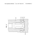 BONE CONDUCTION IMPLANT diagram and image