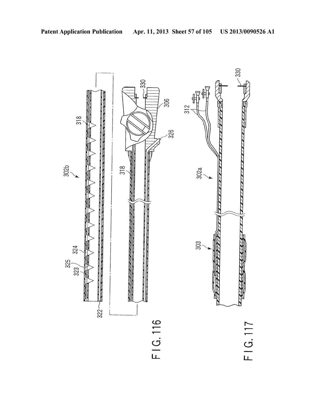 ANASTOMOSIS SYSTEM - diagram, schematic, and image 58