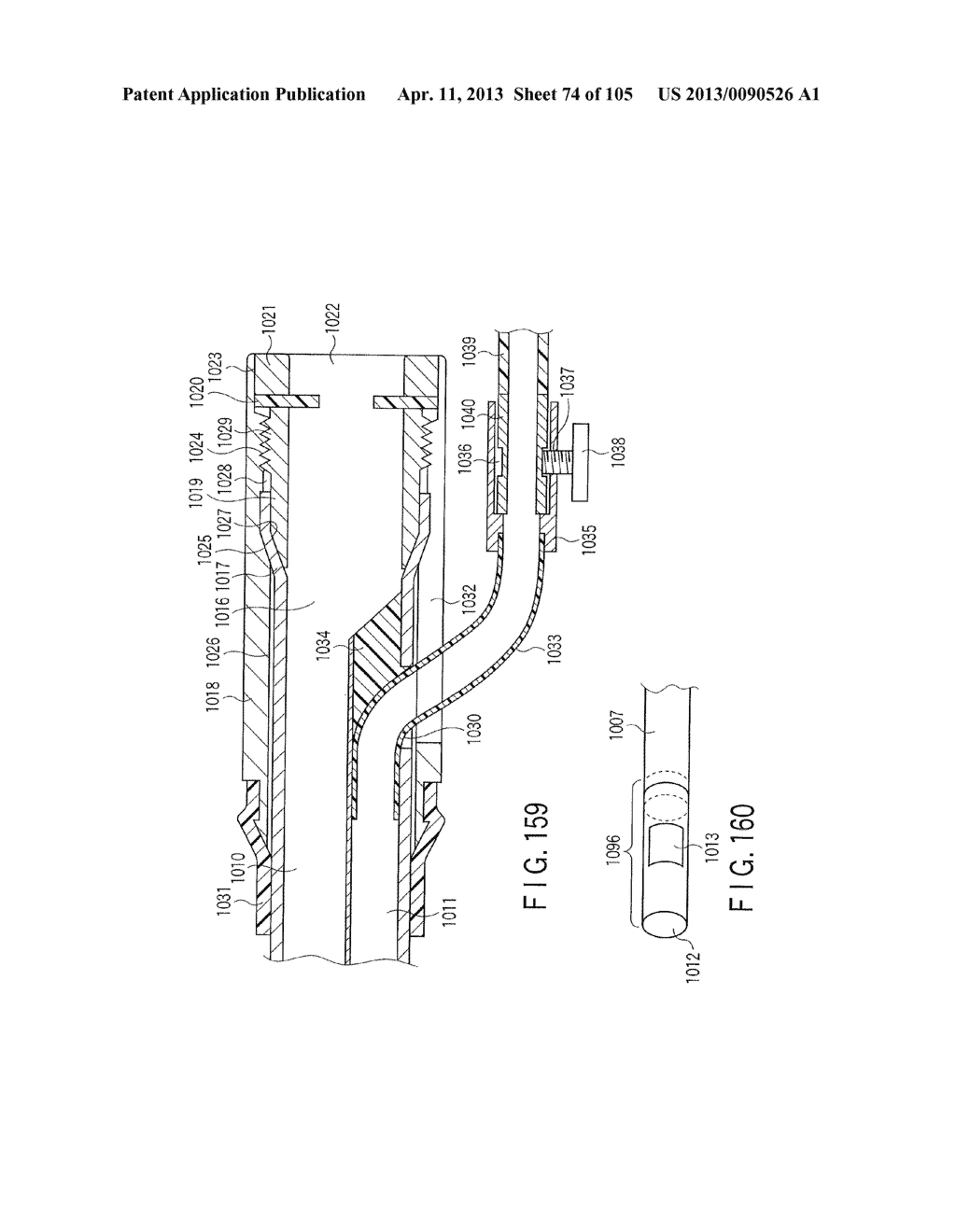 ANASTOMOSIS SYSTEM - diagram, schematic, and image 75