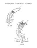 COVERING FOR A MEDICAL SCOPING DEVICE diagram and image