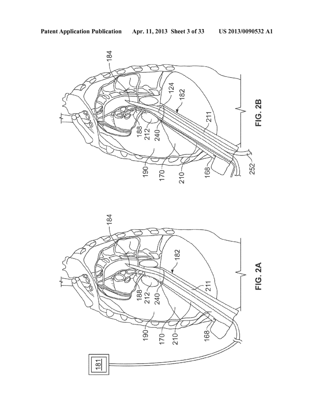 DIAPHRAGM ENTRY FOR POSTERIOR SURGICAL ACCESS - diagram, schematic, and image 04