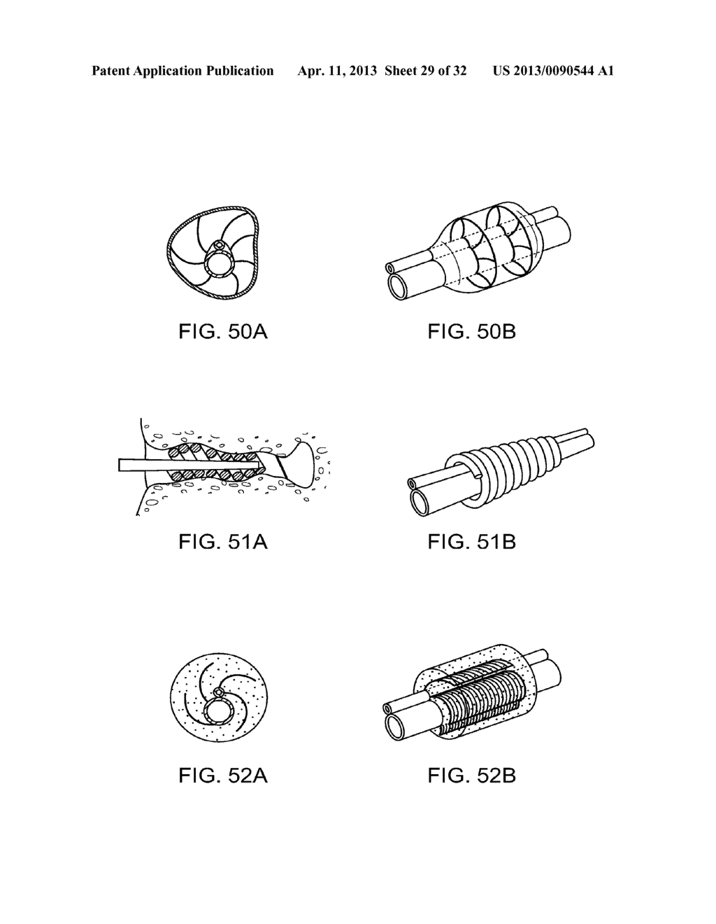 SYSTEM AND METHOD FOR THE SIMULTANEOUS BILATERAL TREATMENT OF TARGET     TISSUES WITHIN THE EARS USING A GUIDE BLOCK STRUCTURE - diagram, schematic, and image 30