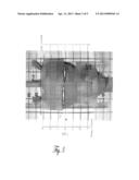 METHODS AND APPARATUSES FOR THE LOCALIZATION AND TREATMENT OF CANCER diagram and image