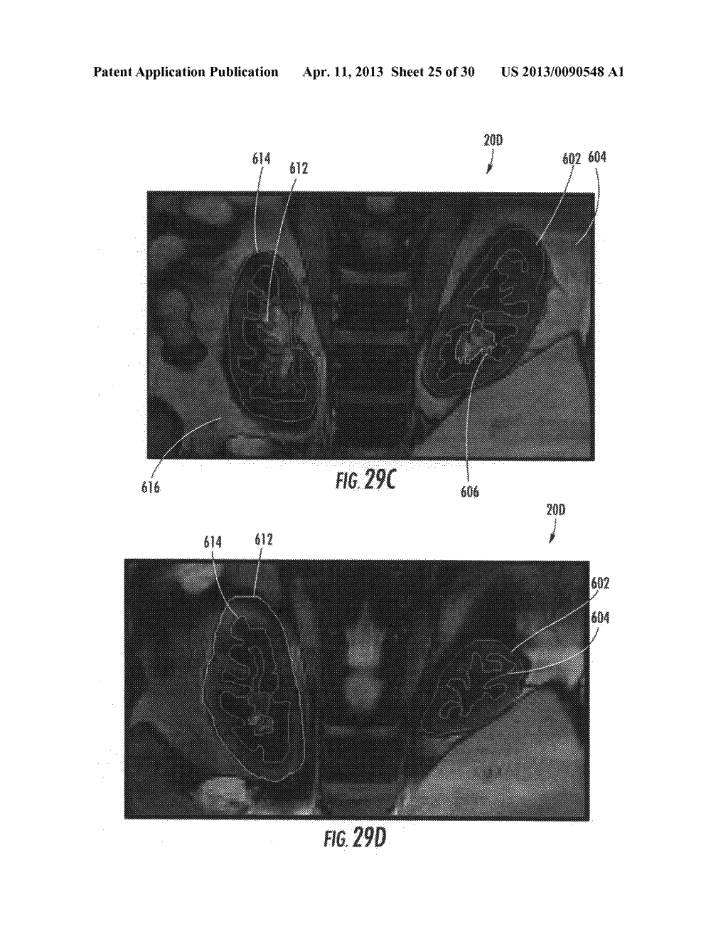 AUTOMATED RENAL EVALUATION SYSTEMS AND METHODS USING MRI IMAGE DATA - diagram, schematic, and image 26