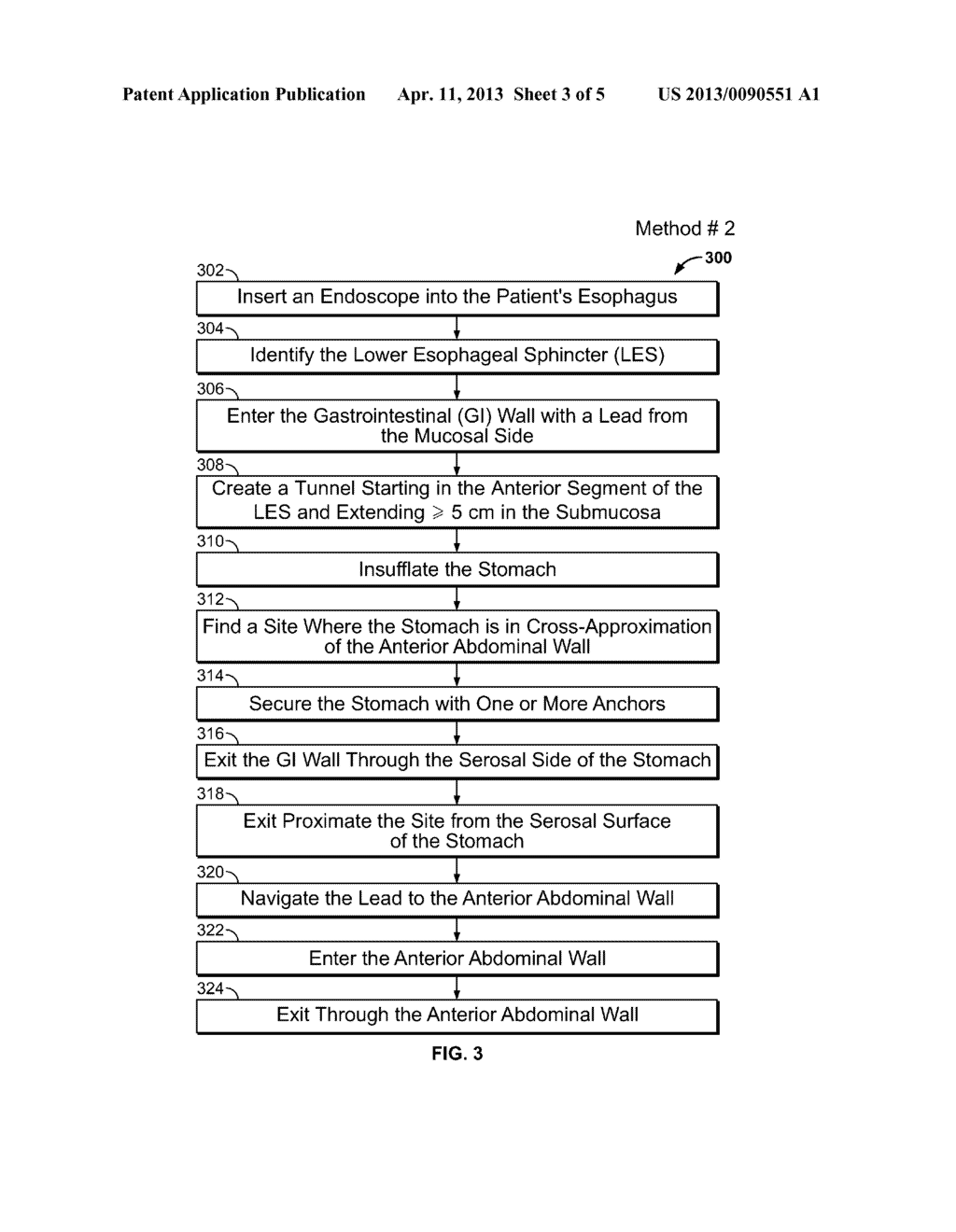 ENDOSCOPIC LEAD IMPLANTATION METHOD - diagram, schematic, and image 04